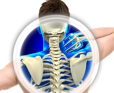 La cervicale come individuare i sintomi più comuni